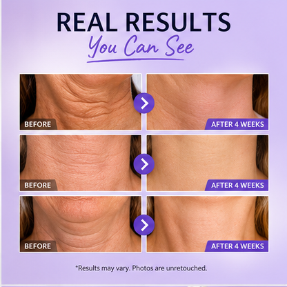 Advanced Neck Firming Cream